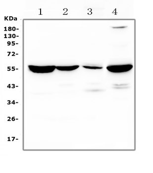 Argininosuccinate Lyase/ASL Rabbit Polyclonal Antibody