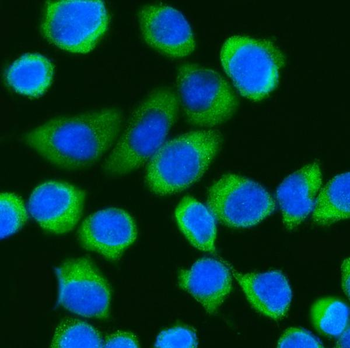 DDX3/DDX3X Rabbit Polyclonal Antibody