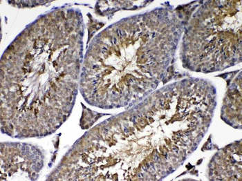 PARK7/DJ1 Rabbit Polyclonal Antibody