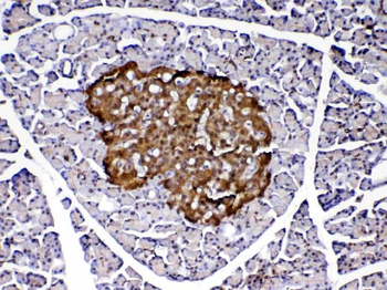 PARK7/DJ1 Rabbit Polyclonal Antibody