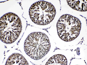 PARK7/DJ1 Rabbit Polyclonal Antibody