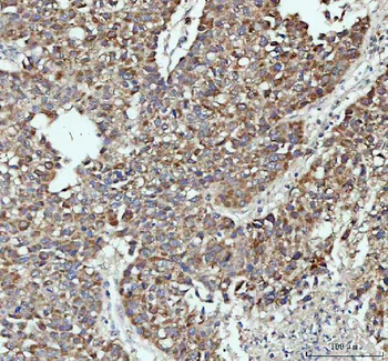 PAH Rabbit Polyclonal Antibody