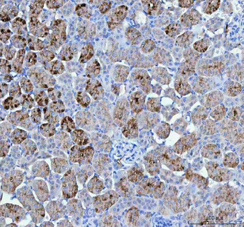 PAH Rabbit Polyclonal Antibody