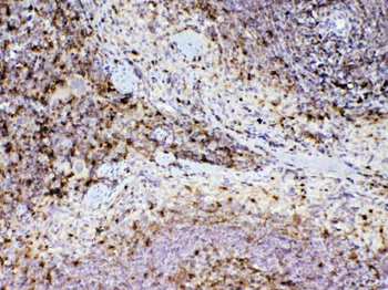 ADA Rabbit Polyclonal Antibody