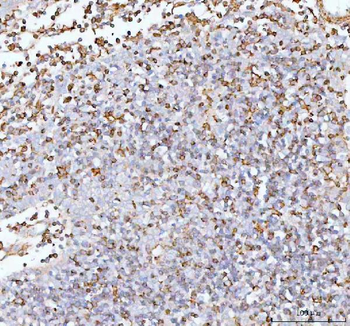 IL-22/IL22 Antibody