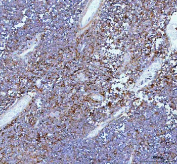 IL-22/IL22 Antibody