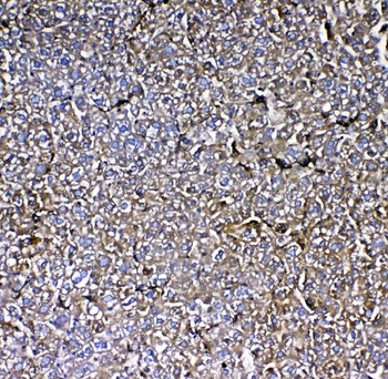 MBL2 Rabbit Polyclonal Antibody