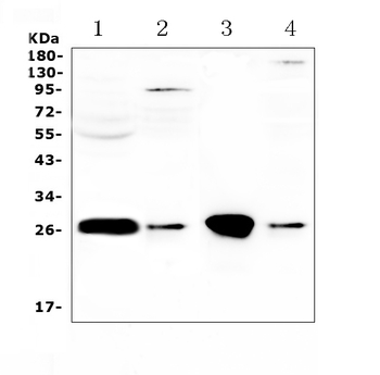 GSTT1 Rabbit Polyclonal Antibody