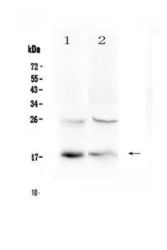 TSLP Rabbit Polyclonal Antibody