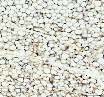 Factor D/CFD Antibody