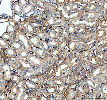 Factor D/CFD Antibody