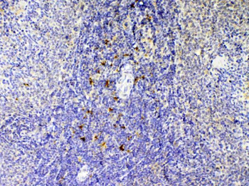 IL12B Rabbit Polyclonal Antibody