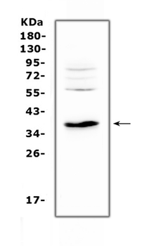 IL12B Rabbit Polyclonal Antibody