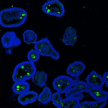MUC2 Antibody