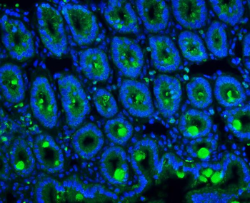 MUC2 Antibody