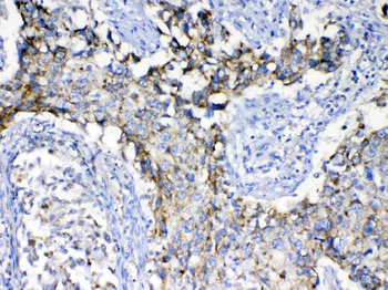 SCF/KITLG Rabbit Polyclonal Antibody