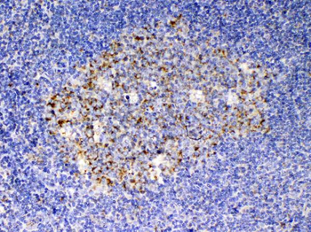 SCF/KITLG Rabbit Polyclonal Antibody