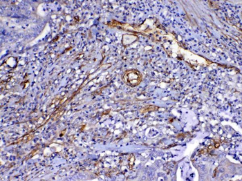 VEGF Receptor 3/FLT4 Antibody