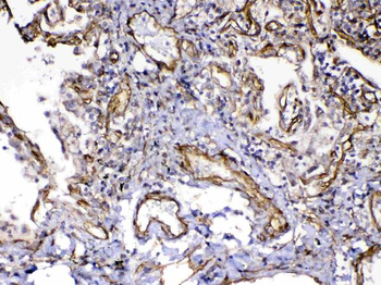 VEGF Receptor 3/FLT4 Antibody