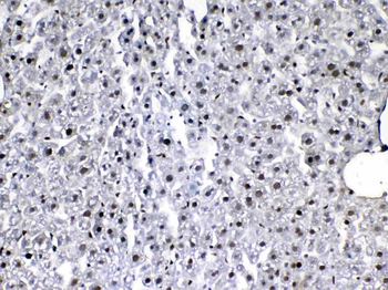 VEGF Receptor 3/FLT4 Antibody