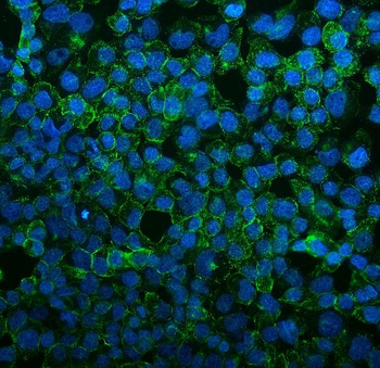 VEGF Receptor 3/FLT4 Antibody