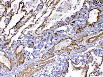 VEGF Receptor 3/FLT4 Antibody
