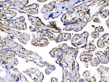 VEGF Receptor 3/FLT4 Antibody