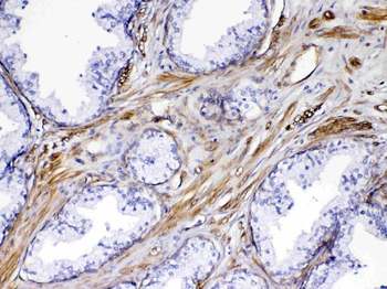 VEGF Receptor 3/FLT4 Antibody