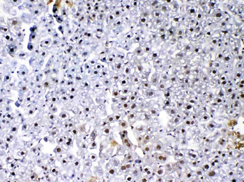 VEGF Receptor 3/FLT4 Antibody