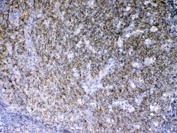Lyn Rabbit Polyclonal Antibody