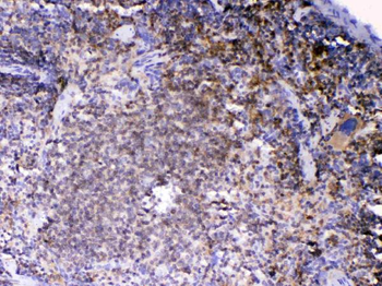 Lyn Rabbit Polyclonal Antibody