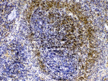 Lyn Rabbit Polyclonal Antibody