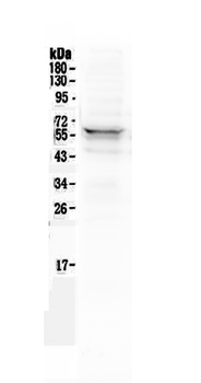Lyn Rabbit Polyclonal Antibody