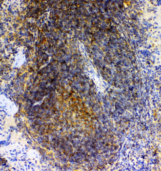 GRK2/GRK2 Rabbit Polyclonal Antibody