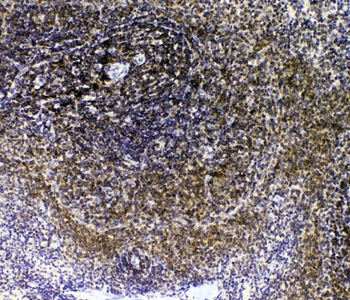 IL-16/Il16/IL Rabbit Polyclonal Antibody