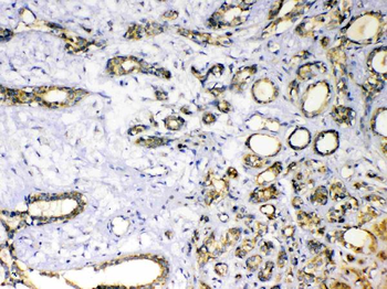 Superoxide Dismutase 3/SOD3 Rabbit Polyclonal Antibody