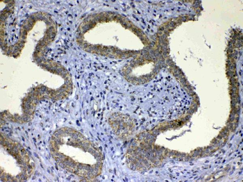 UGT1A1 Rabbit Polyclonal Antibody