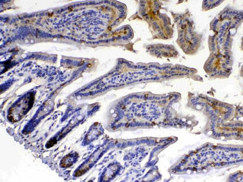 Xanthine Oxidase/XDH Rabbit Polyclonal Antibody