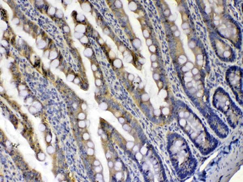 Xanthine Oxidase/XDH Rabbit Polyclonal Antibody