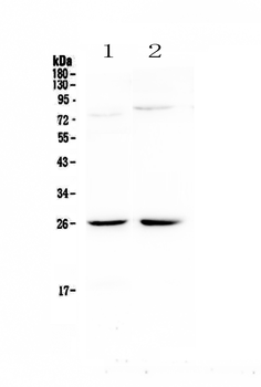 NMU Rabbit Polyclonal Antibody