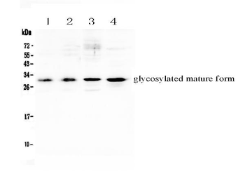 IL17F Antibody