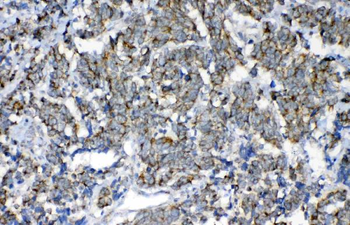 FH Antibody