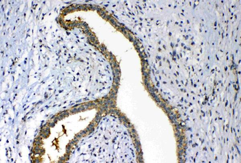 FH Antibody