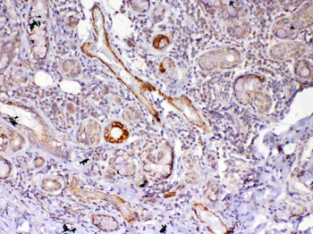 Frizzled 4/FZD4 Rabbit Polyclonal Antibody