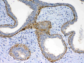 Frizzled 4/FZD4 Rabbit Polyclonal Antibody