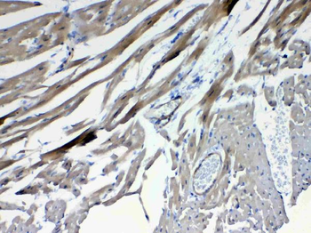 Frizzled 4/FZD4 Rabbit Polyclonal Antibody