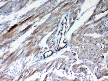 Frizzled 4/FZD4 Rabbit Polyclonal Antibody