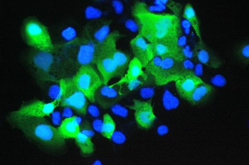 Psoriasin/S100A7 Rabbit Polyclonal Antibody