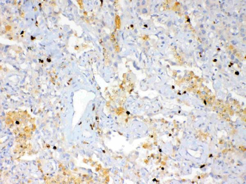 Psoriasin/S100A7 Rabbit Polyclonal Antibody