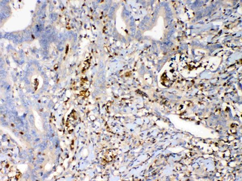 Psoriasin/S100A7 Rabbit Polyclonal Antibody